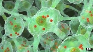 Parkinson’s disease news for Dubai