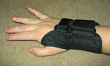 carpal tunnel syndrome wrist, Dubai