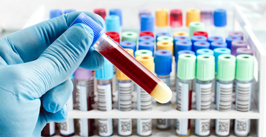 Parkinson’s Disease Dubai – what’s new this week?
