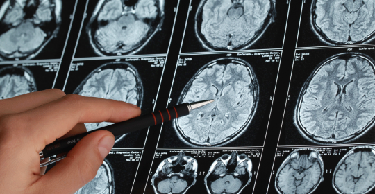Diabetic Pain | Mystery Might Be Unveiled | Hope For Sufferers