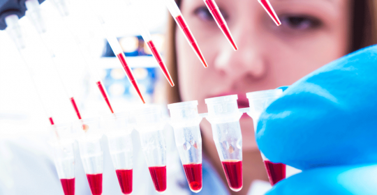 Stem Cell Therapy in Multiple Sclerosis – first-of-its-kind study