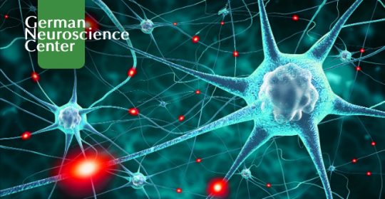 Seizure Disorders: Definition, Symptoms, Causes, and Diagnosis