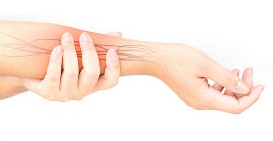 Treatment for Nerve Problems in Dubai