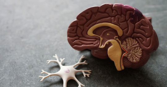Parkinson’s Disease – A Progressive Neurological Disorder