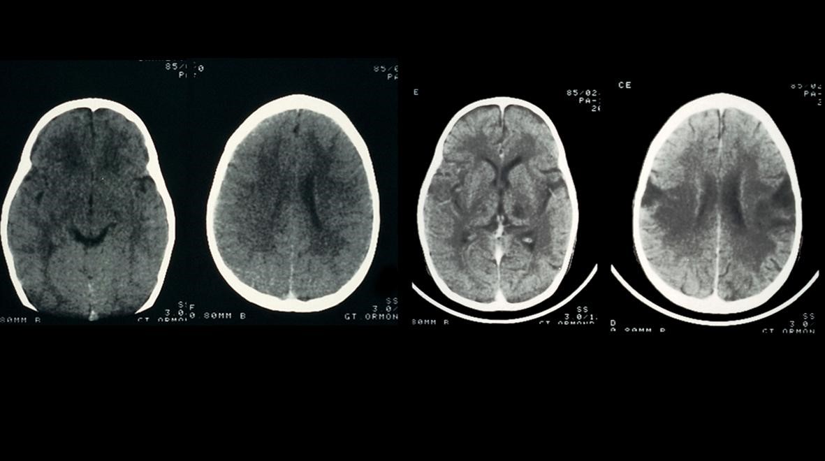 brain fever media circular studio 1.2 brain fever media circular studio 1.2
